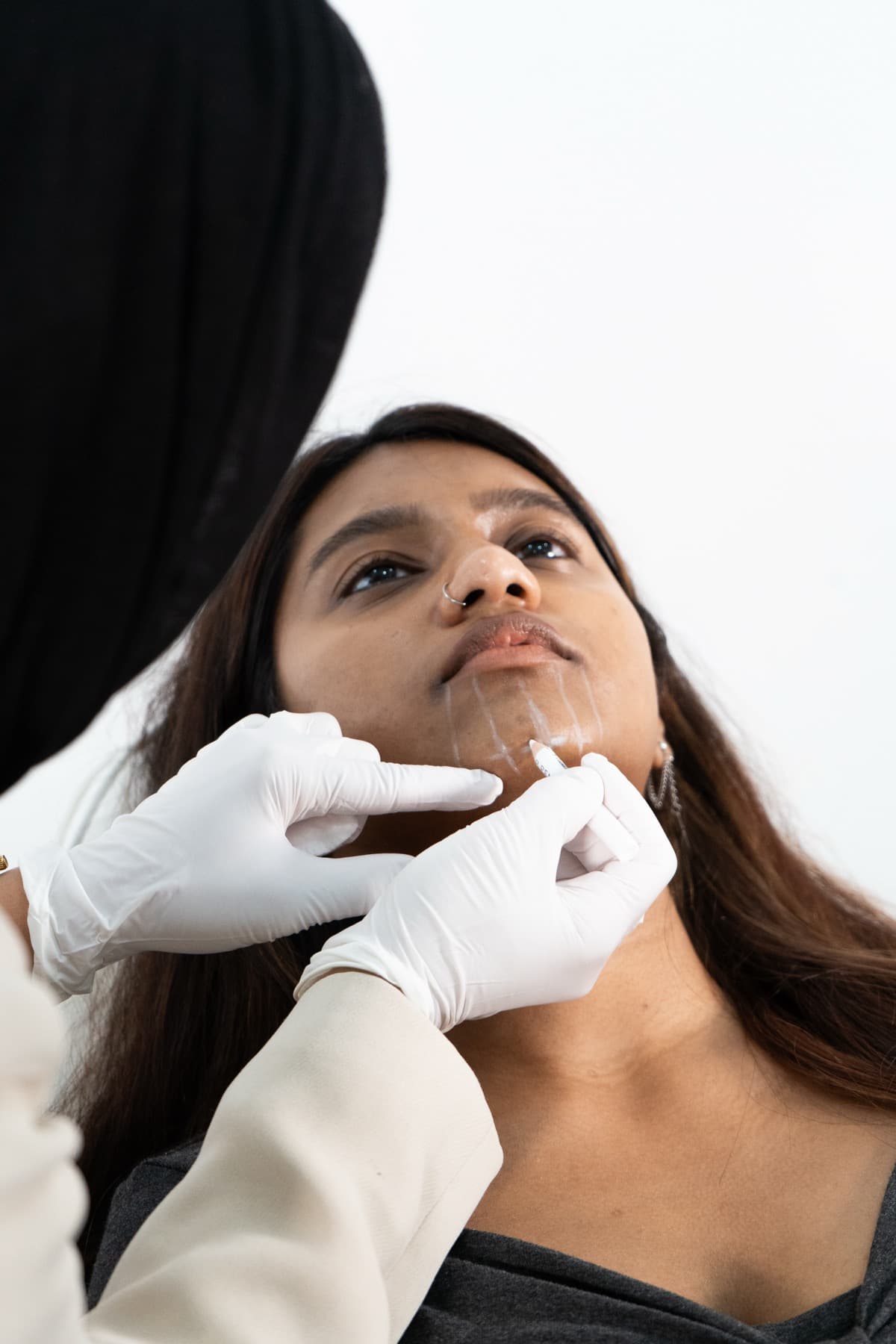 Chin filler treatment in progress at House of Riri