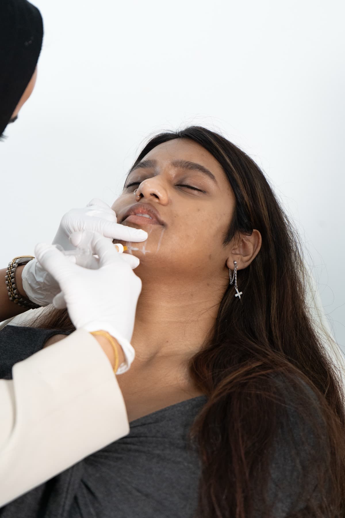 Chin filler treatment in progress at House of Riri