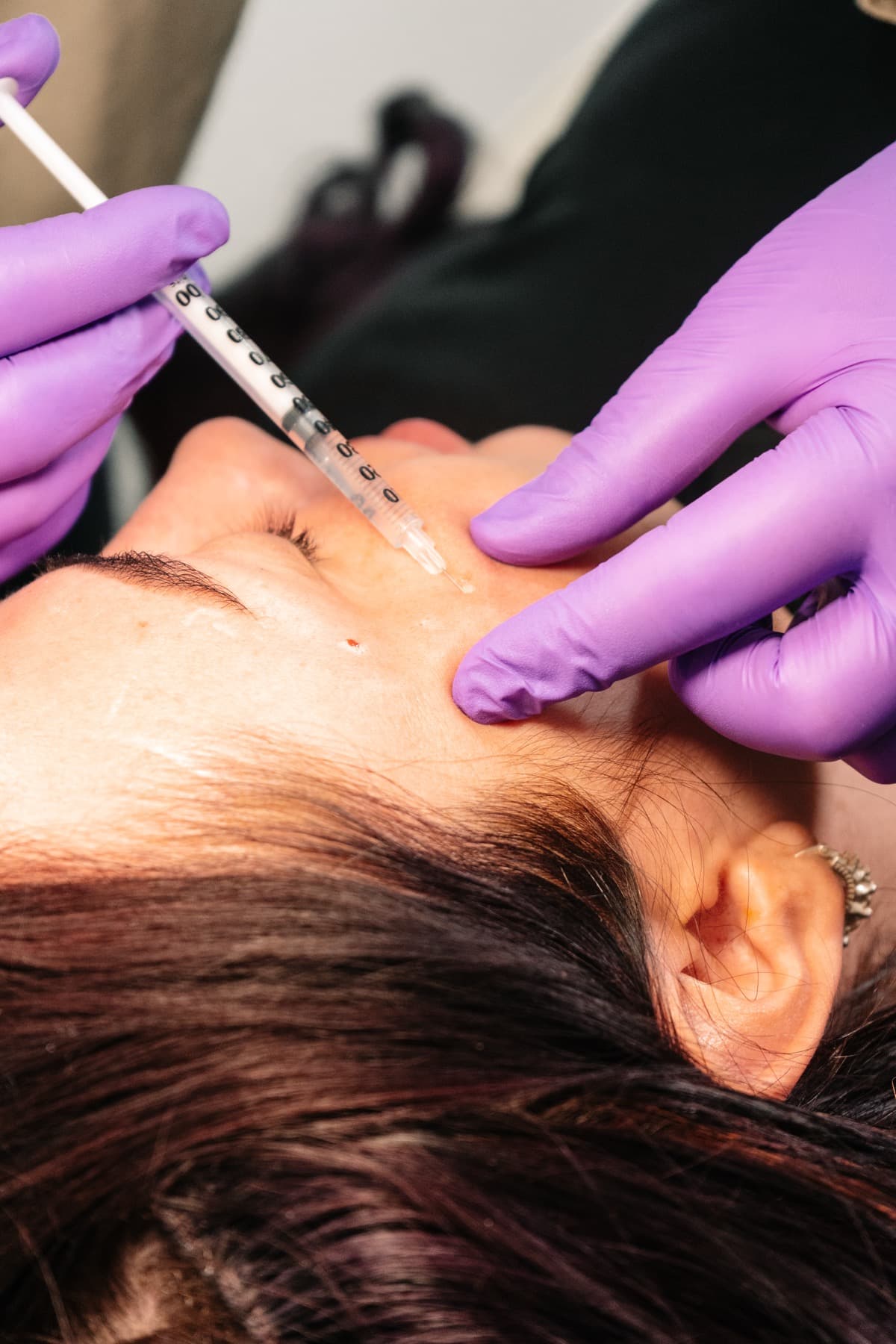 Filler dissolving treatment in progress at House of Riri