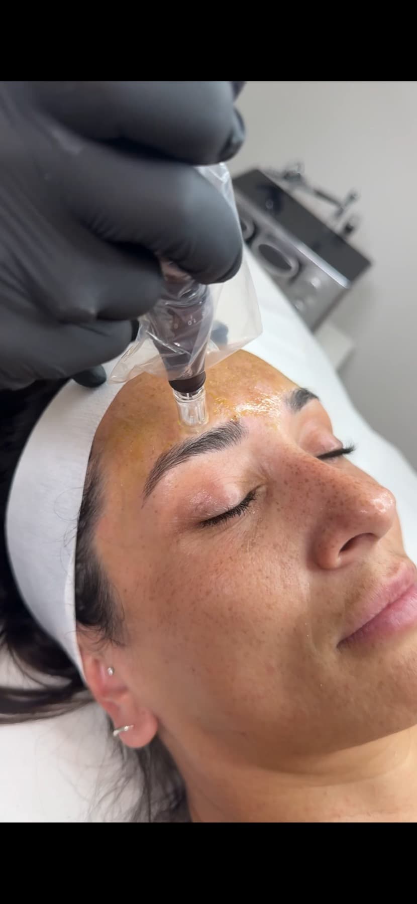 Skin treatment in progress at House of Riri