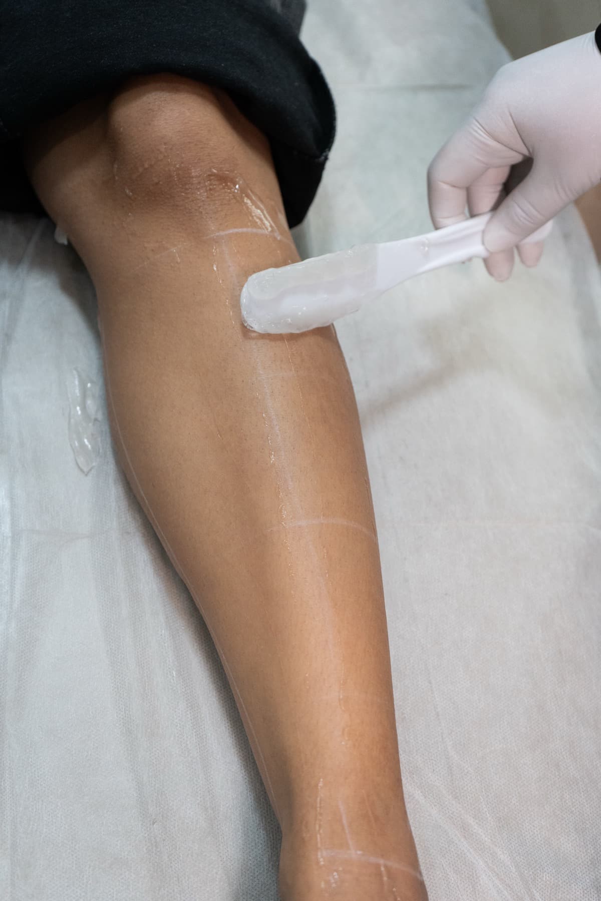 Laser hair removal treatment at House of Riri
