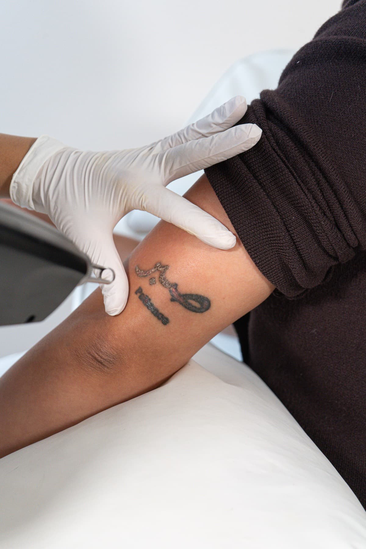 Laser tattoo removal treatment at House of Riri