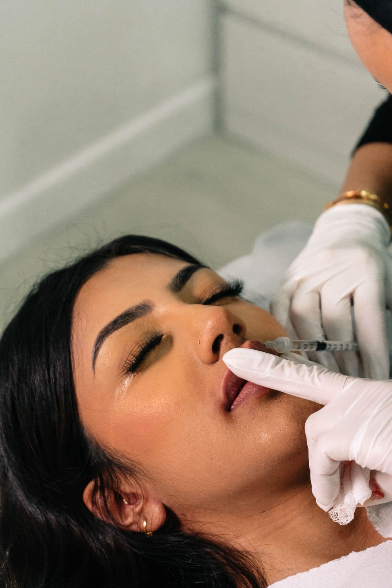 A real lip filler injection in progress at House of Riri