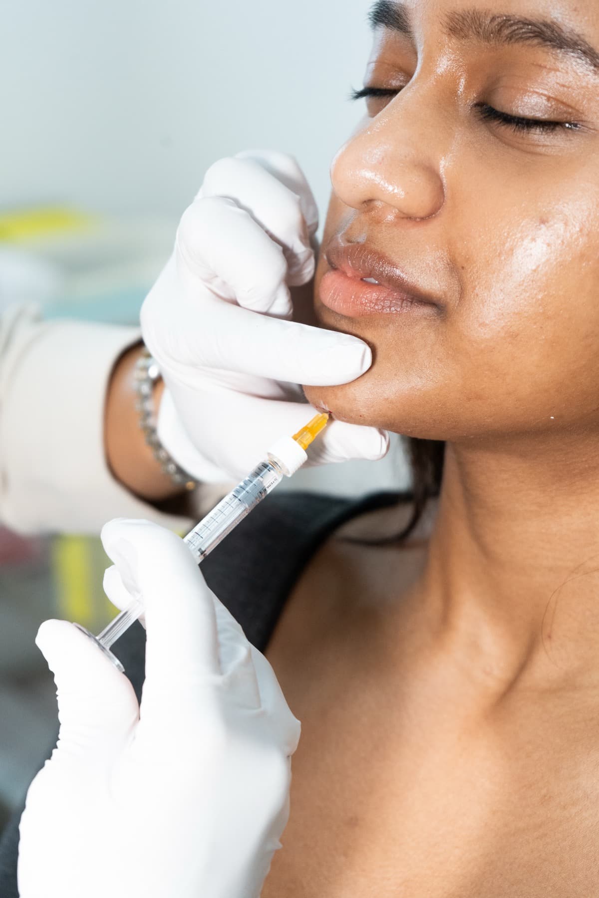 Chin filler treatment at House of Riri