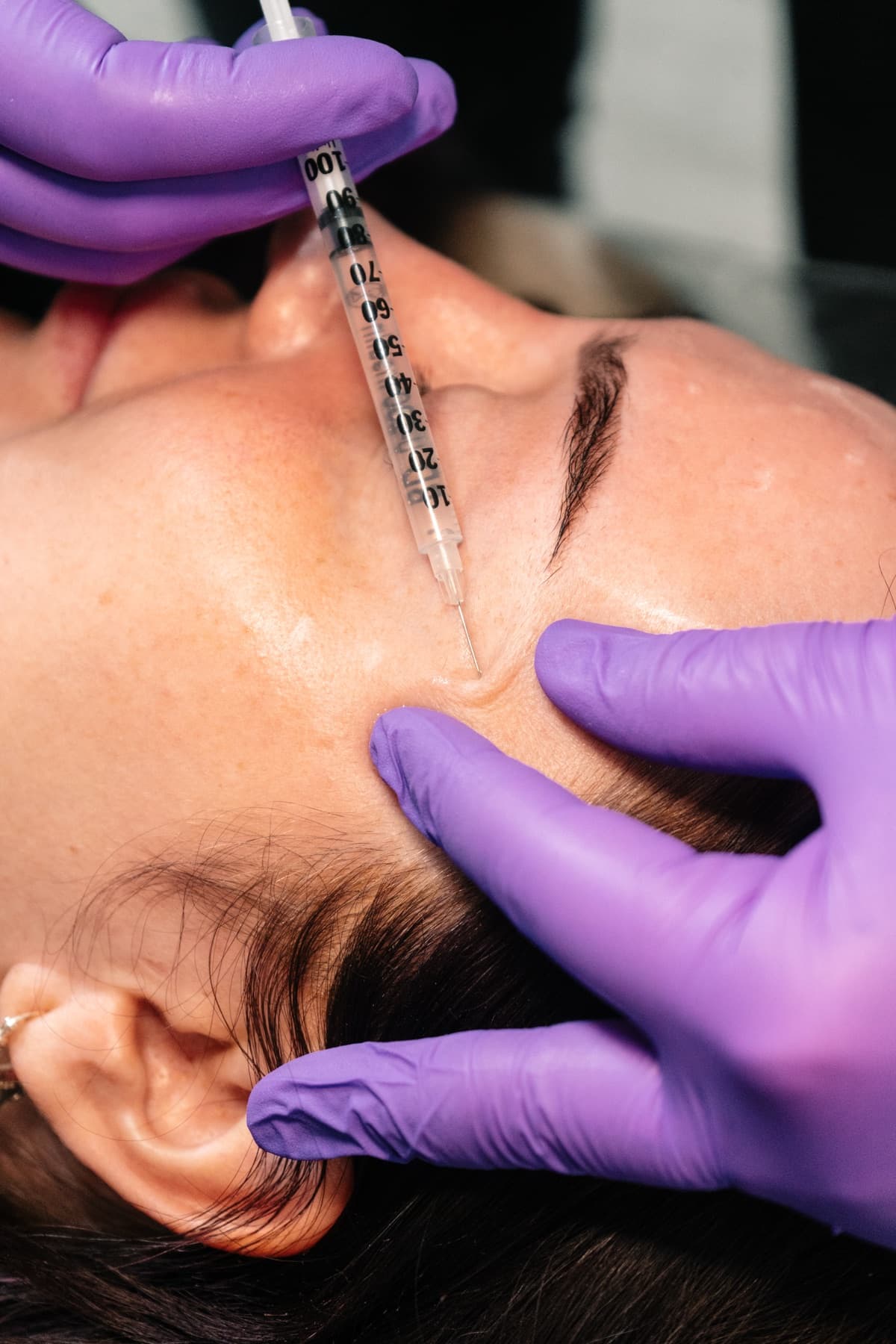 Filler dissolving being injected at House of Riri