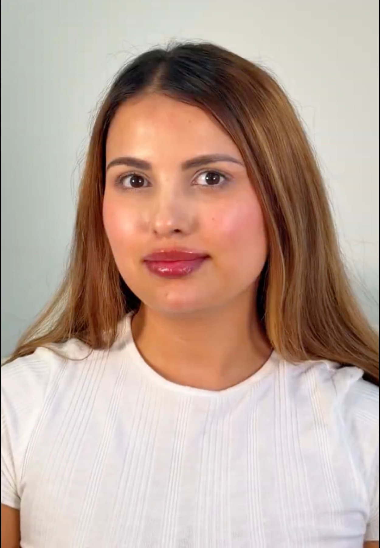 Natural lip filler result