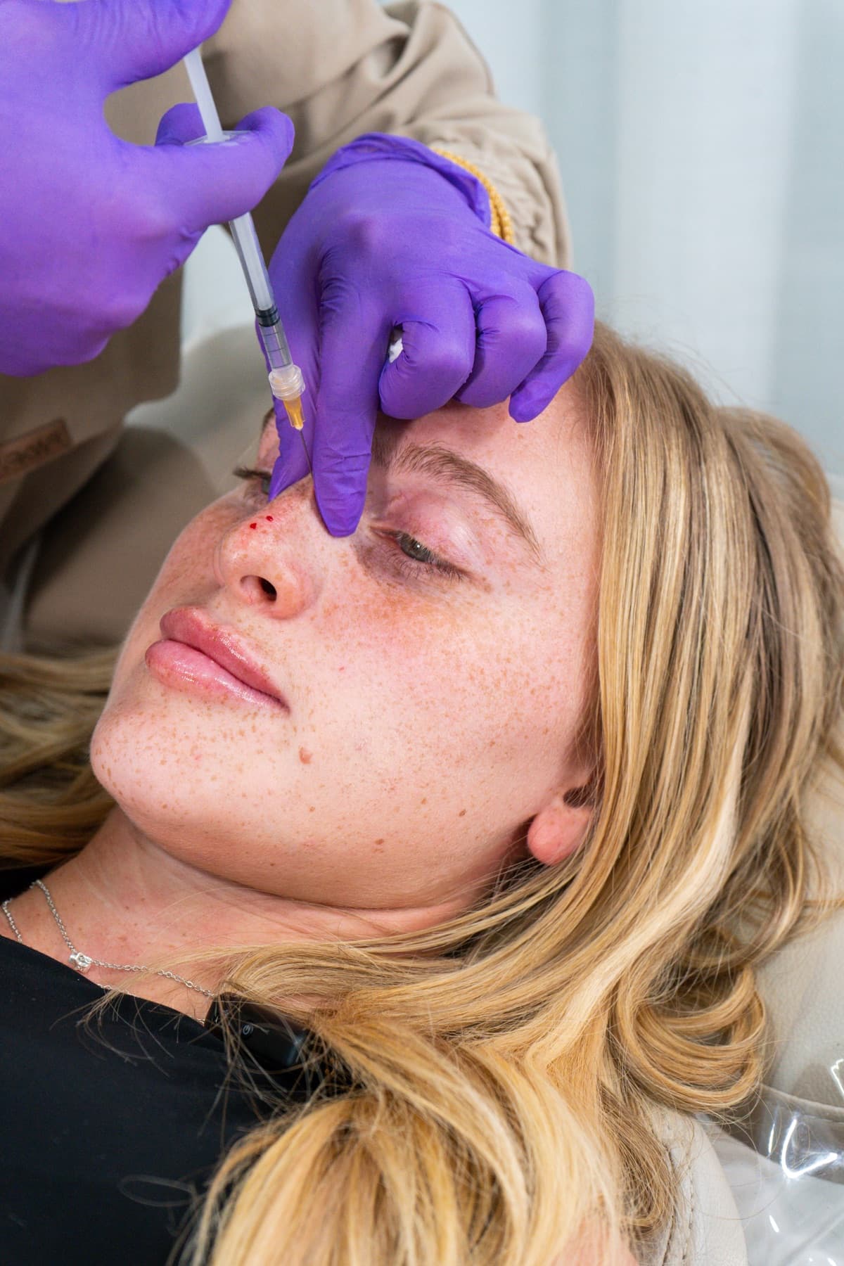 Non-surgical rhinoplasty treatment in progress at House of Riri