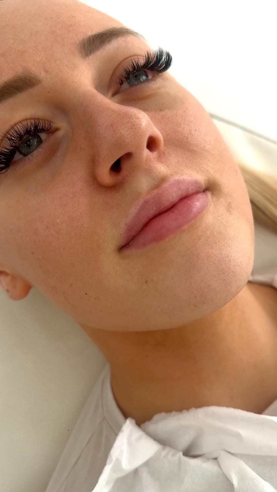 Profile balancing filler result, front view