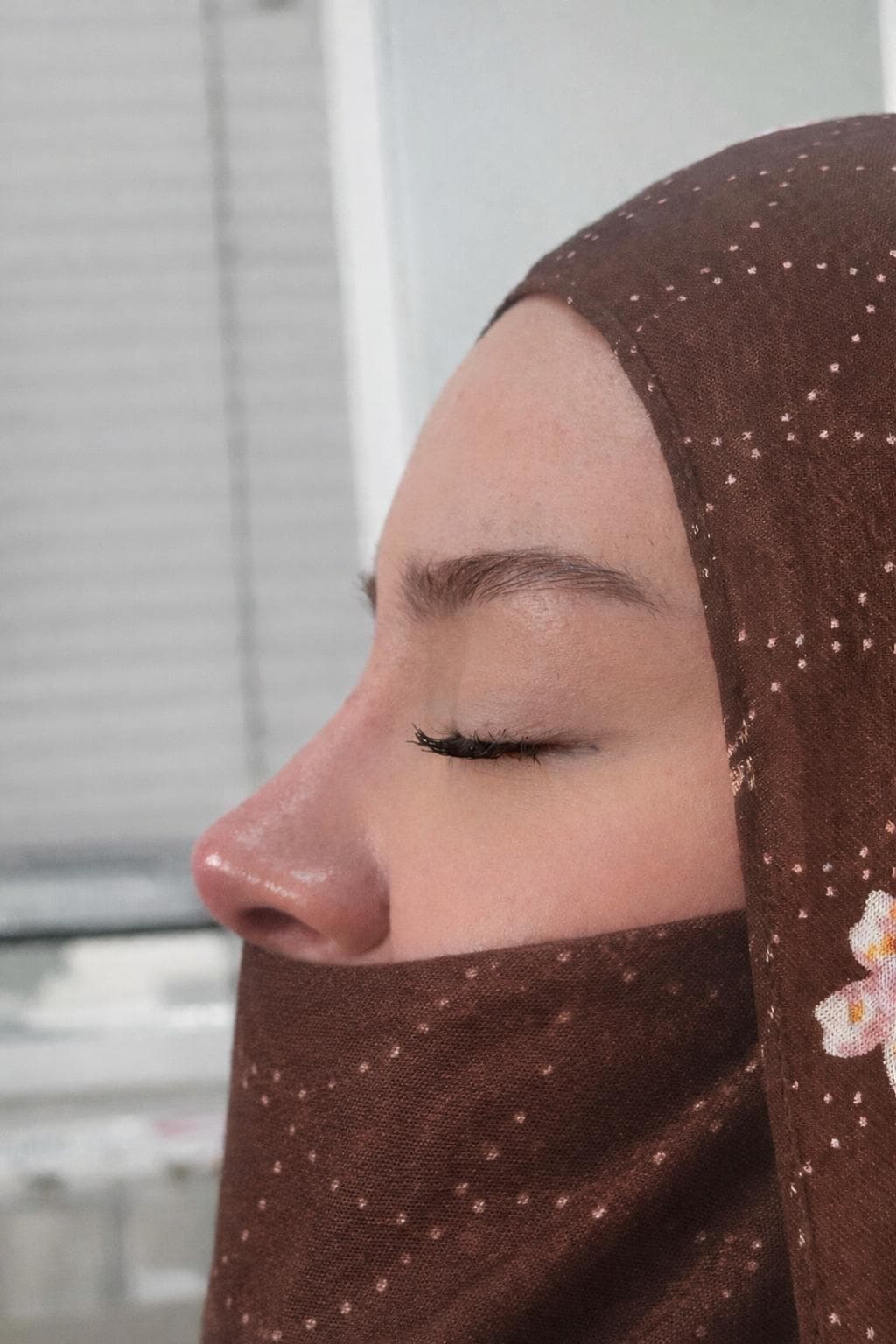 Non-surgical rhinoplasty result, close-up side profile